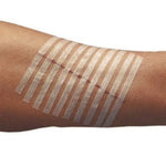 Sterile Wound Closure Strips